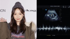 Goo Hara's Brother Wish During Late Idol's Funeral Came True: Find Out What is it