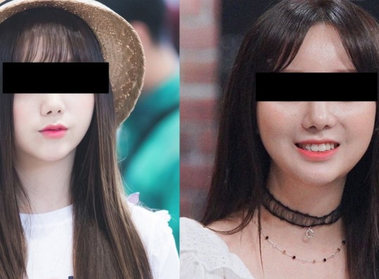 K-netizens Reacts to this Female Idol’s Alleged “Nose Job”; Think it’s a Failure