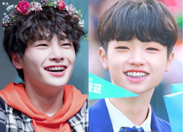 These K  Pop  Idols  With Braces On Are The Cutest KpopStarz