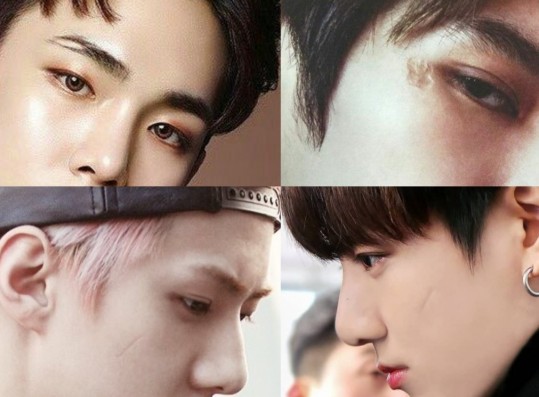 These K-pop Idols Have Scars on Their Faces Yet So Stunning and Lovely