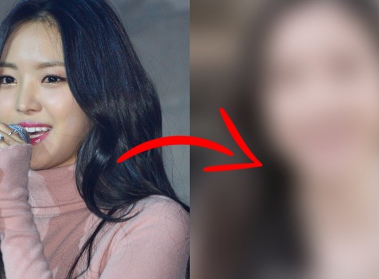 Ex-Apink Son Naeun Accused of Having Cosmetic Surgery