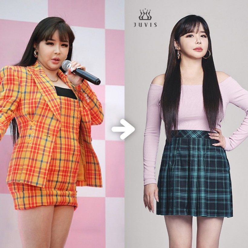 Former 2NE1 Park Bom Draws Attention Due To Recent Appearance – Here's Why