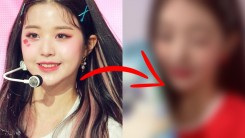 IVE Jang Wonyoung Suspected to Have Undergone Double Eyelid Surgery