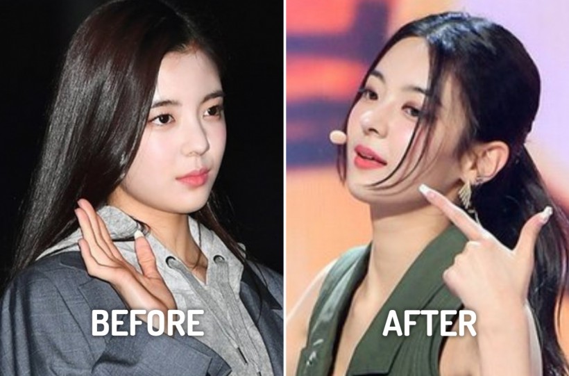 ITZY Lia Suspected to Have Undergone Plastic Surgery Recently — Here's Why