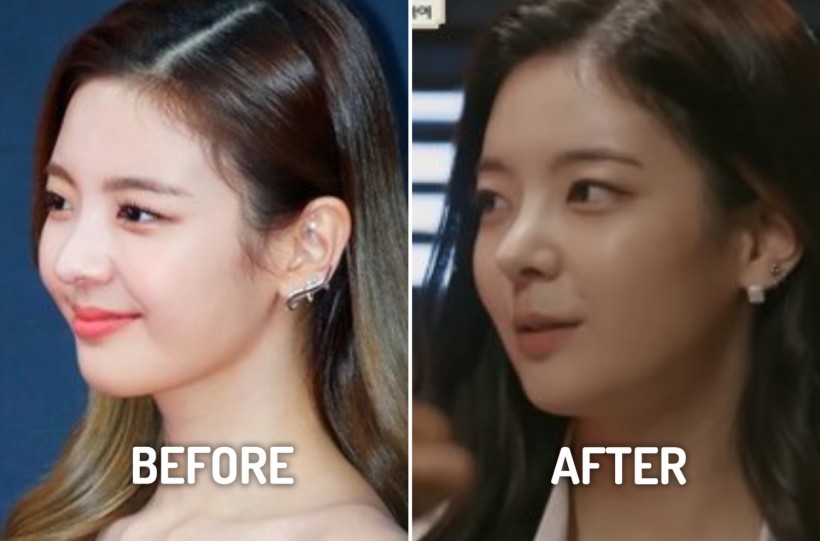 ITZY Lia Suspected to Have Undergone Plastic Surgery Recently — Here's Why