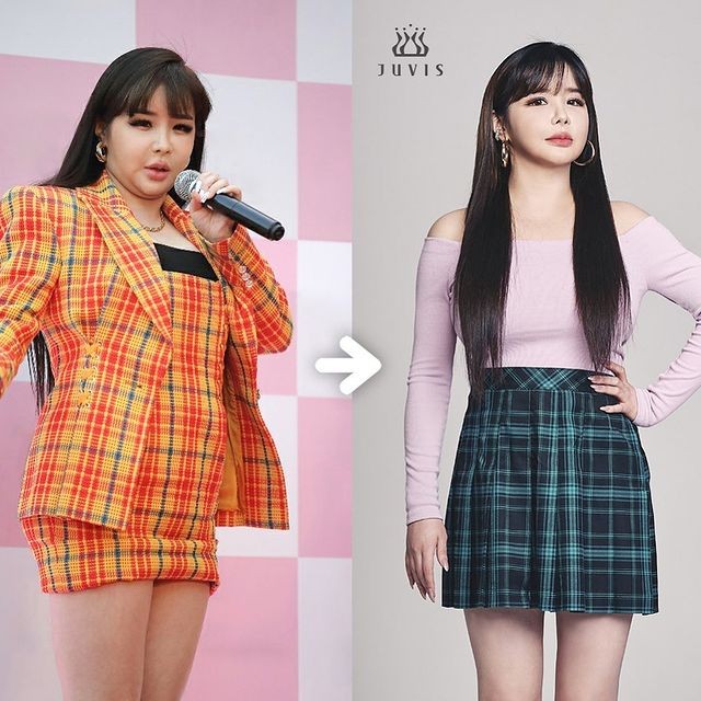 Park Bom Draws Divided Reactions For Drastic Change In Appearance After 1 Year