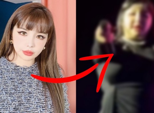 Park Bom Draws Divided Reactions For Drastic Change In Appearance After 1 Year