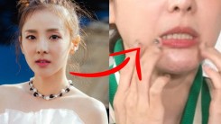 Sandara Confesses Side Effects After She Did THIS To Face– What Happened?