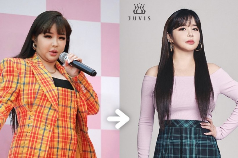 2NE1 Park Bom Unrecognizable in Weight Loss Revealed by Unedited Video