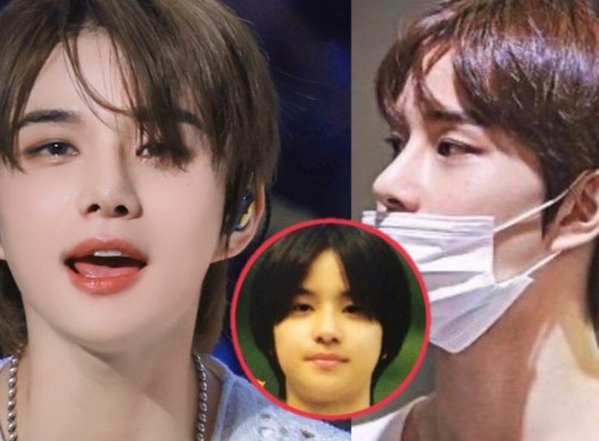 NCT Jungwoo Accused of Having Nose Job After Idol's Pre-Debut Pics Resurfaced