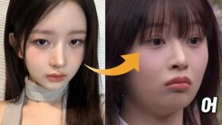 IVE Rei Becomes Hot Topic for Speculated Plastic Surgery — DIVEs Defend Idol