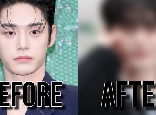 ZEROBASEONE Kim Jiwoong's Looks Before vs. After Scandal Draws Attention Online