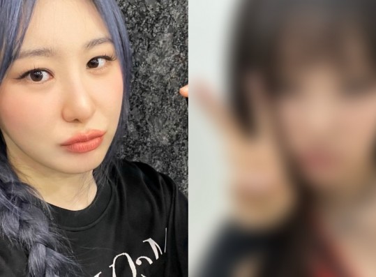 Lee Chaeyeon Reveals She Burned Her Hair While Drunk +  THIS Idol Helped Her