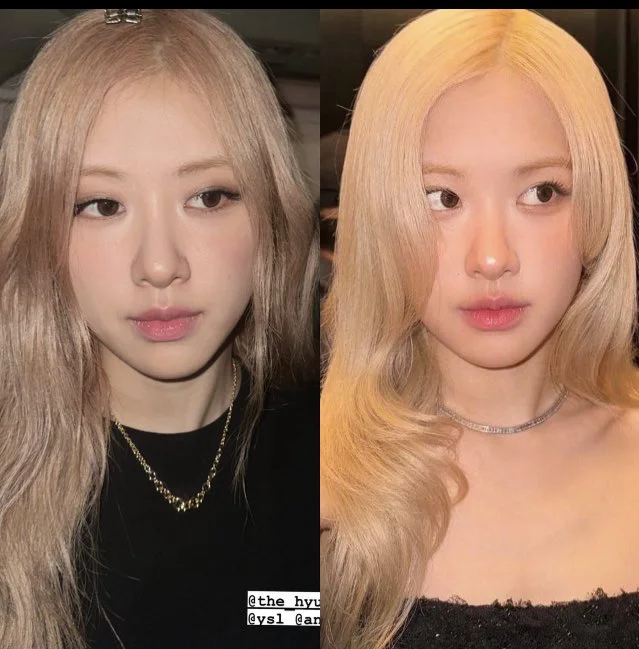 BLACKPINK Rosé Shines in Latest Appearance Following Plastic Surgery Rumors